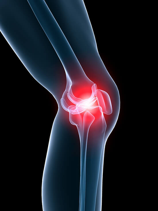 térd- és karfájdalmak a vállízület deformáló arthrosisának kezelése